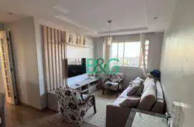 Apartamento com 2 dormitórios à venda, 69 m² por r$ 509.000,00 - vila granada - são paulo/sp